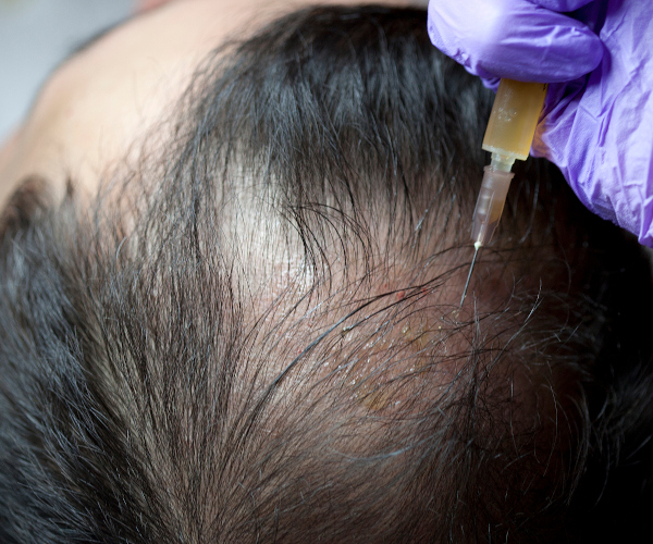 Sitara Medical Clinic Ireland's Premium Facial Aesthetic Clinic