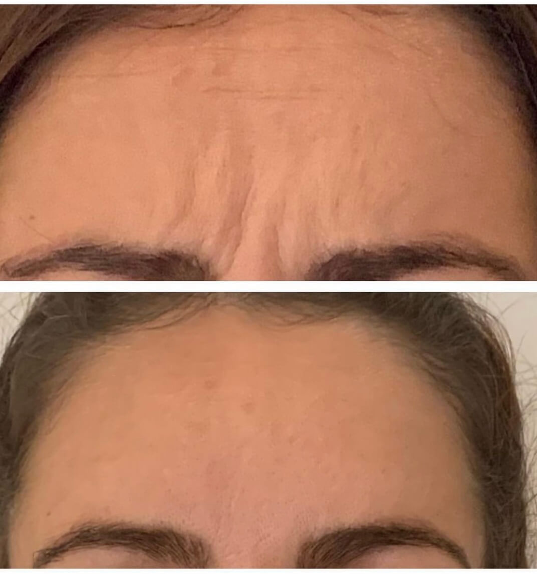 Sitara Medical Clinic Ireland's Premium Facial Aesthetic Clinic