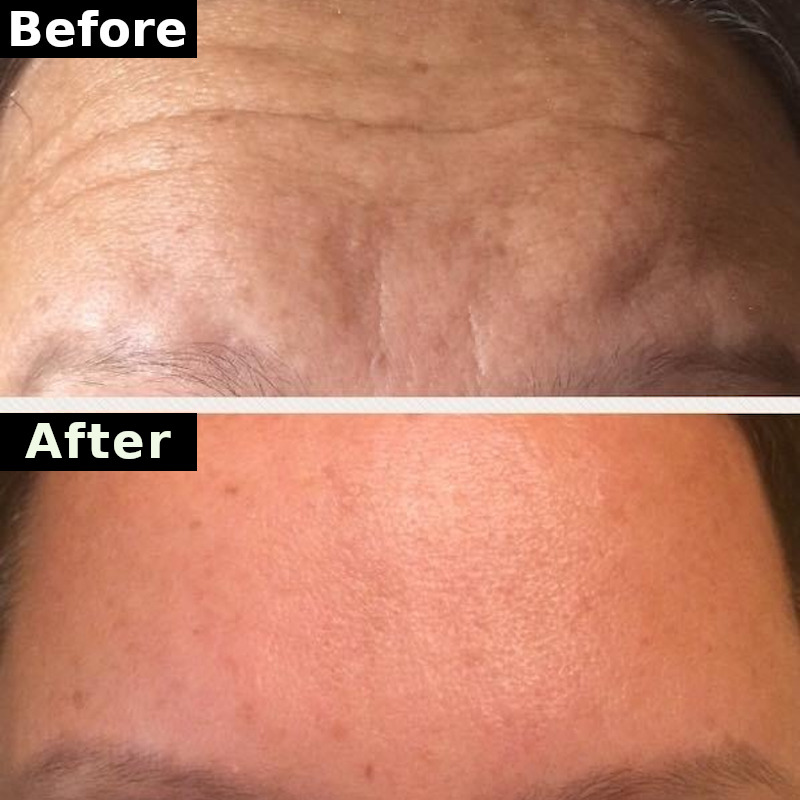 Sitara Medical Clinic Ireland's Premium Facial Aesthetic Clinic