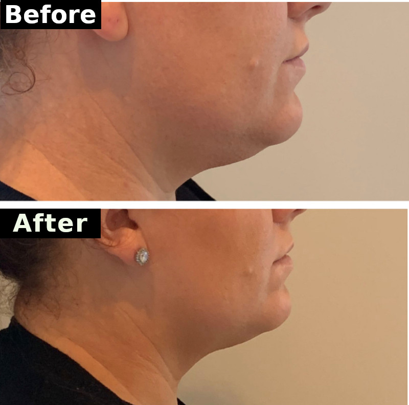 Sitara Medical Clinic Ireland's Premium Facial Aesthetic Clinic