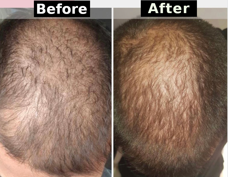 Sitara Medical Clinic Ireland's Premium Facial Aesthetic Clinic